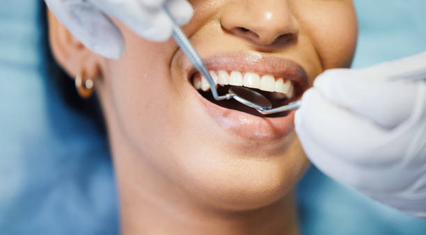 Best Emergency Wisdom Teeth Removal in Crivitz, WI